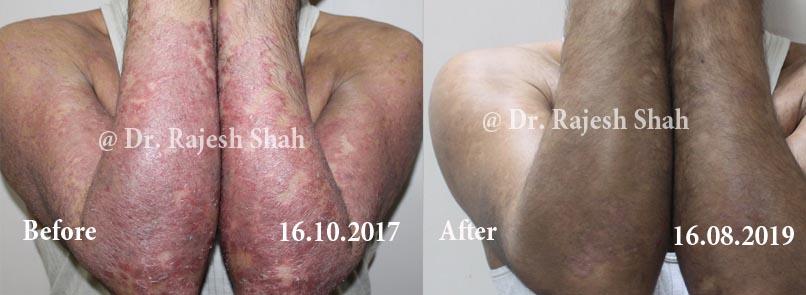 lifeforce homeopathy case-photos